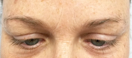 eyebrow microblading before