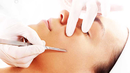dermaplanning treatment