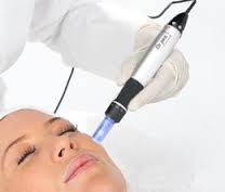 microneedle skin treatment